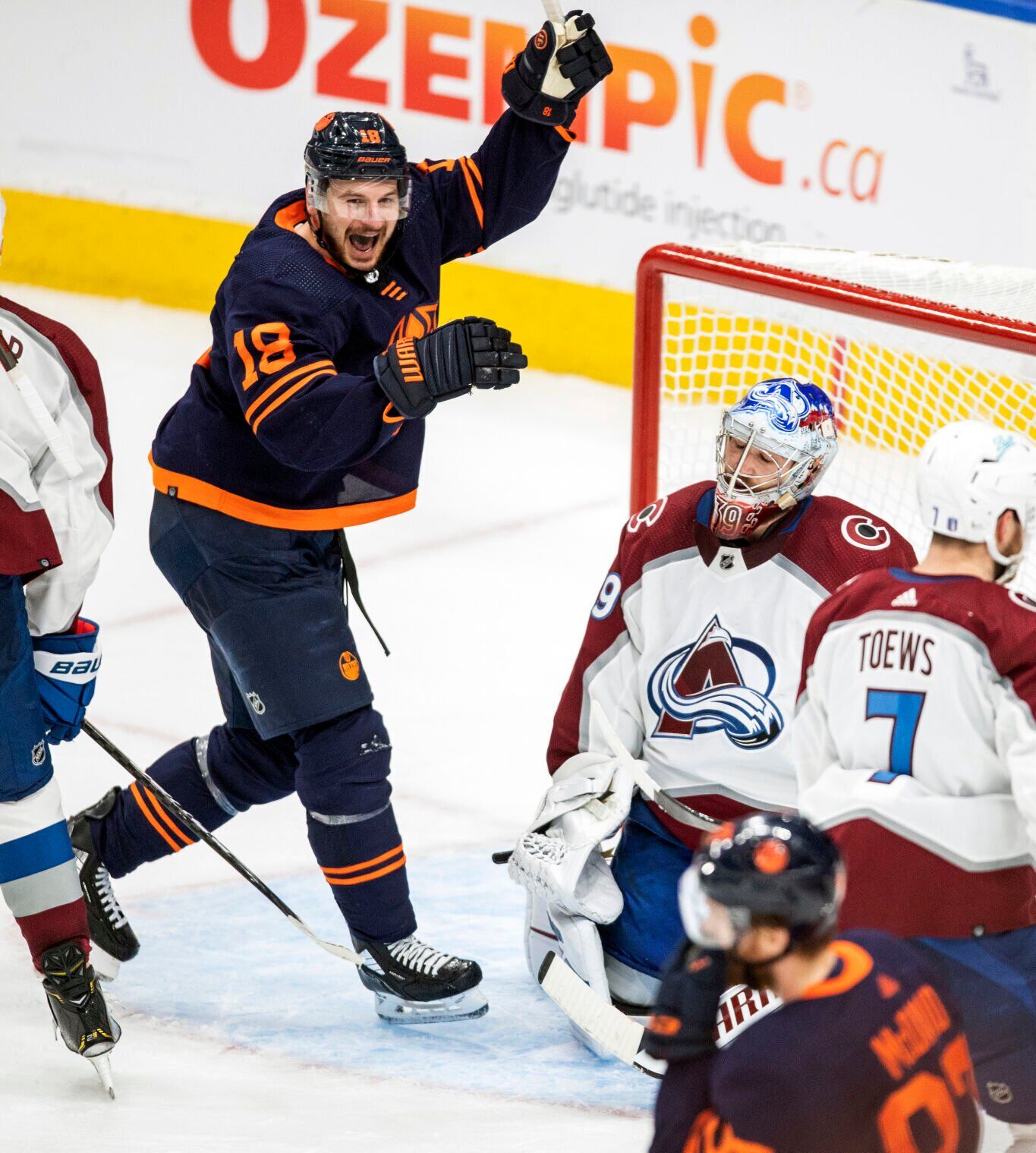 APTOPIX Avalanche Oilers Hockey